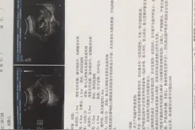 第一胎龙凤胎，二胎又是双胞胎，感谢上天对我的恩赐！图片