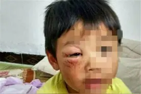男子虐待亲生儿晒图 为什么父母会虐待孩子图片