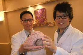 小脑萎缩能活多久 怎么治疗图片