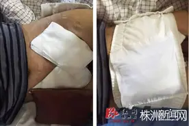 快来围观中心医院护士们的小发明吧图片