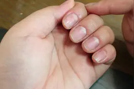 指甲护理技巧：如何正确剪指甲?视频封面