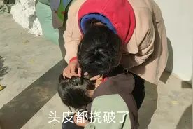 孩子头痒的厉害，农村姑姑担心是长虱子，原来是虚惊一场视频封面