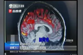 熬夜会“变傻”？脑科专家：别害怕，可以及时补睡回来视频封面