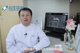 种植牙的品牌该怎么选？差别在哪里？视频封面