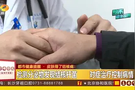 皮肤也会的结核病？男子四肢皮肤红肿破溃，误当过敏加重病情视频封面