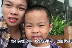 儿子之前撞到床角，现在脸上有个凹陷，医院看了3个科室都没结果视频封面