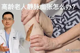 高龄老人静脉曲张破裂怎么办？图片