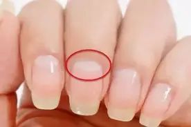 指甲上月牙越多越健康？图片