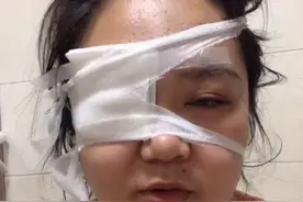 我为你剖腹7层，你却想让我变瞎？生娃后才知孩子“杀伤力”多强图片