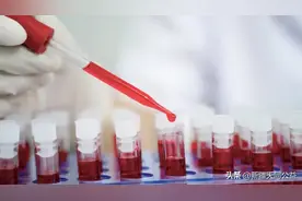 希望曙光？女子感染HIV数年后居然奇迹自愈了...图片