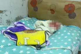 心疼！3月大女婴家中头皮被啃，露出骨头 ！“真凶”让人毛骨悚然…图片