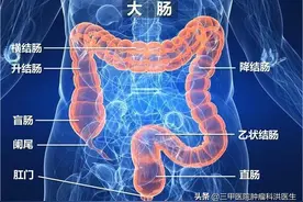 一文读懂：结肠癌的早中晚期与对应的治疗方法和预后图片