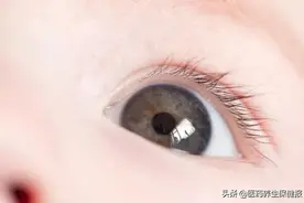 大多数“飞蚊症”不用治！那就不用检查了吗？图片
