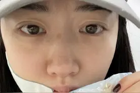 33岁景甜晒拔牙照，还穿高腰短裙秀大长腿，网友：姐素颜也好好看图片
