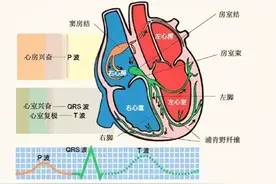 体检做了个心电图，发现“室性早搏”，这要紧吗？图片