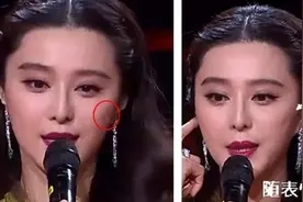 半个娱乐圈女明星脸上都有的这个坑，真的是线雕的锅吗？图片