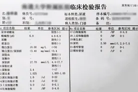 尿常规中的“+”号，都是什么意思？教你读懂尿常规里的各种项目图片