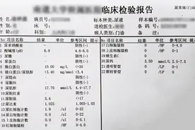 尿常规中的“+”号，都是什么意思？教你读懂尿常规里的各种项目图片