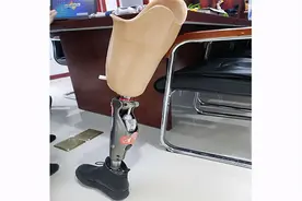 「假肢」手假肢的安装难度大吗？有何要求？图片