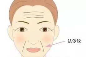 法令纹是如何形成的？怎么改善弱化法令纹？图片