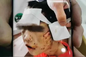 气愤！4岁女童遭生父继母虐打进ICU！警方最新通报：两人已被刑拘！图片