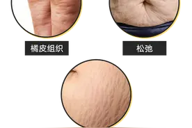 橘皮！松弛！这些胖过的“痕迹”，90%都可以改善图片