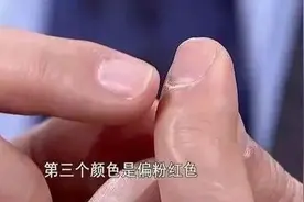 手指甲长这样，多半是身体在求救！6种变化一个比一个危险图片