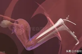 辽宁：试管婴儿2男胎，一朝分娩全傻眼，难道是狸猫换太子图片