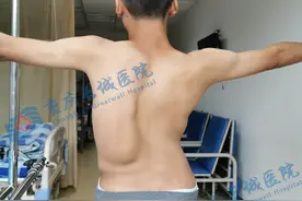 重铸脊梁！关注15岁脊柱侧弯少年重获新生！图片