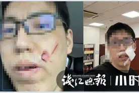 小伙跟同事玩密室逃脱，被木板戳伤左脸：“我都没脸见人了，单位都没法去”图片