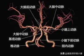 头颅血管磁共振（MRA）解剖--精品图集图片