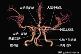 头颅血管磁共振（MRA）解剖--精品图集图片