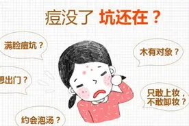 满脸痘坑，到底该用啥来填？我迷惑了...图片
