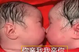 龙凤胎兄妹刚出生就“一直亲”，护士分都分不开，这画面太有趣图片