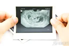 什么是阴式B超？不要害羞，其实3种女性还不太适合做图片