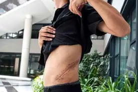 身高1米9的小王，体重只有120斤，只因曾用肾换了一部苹果手机图片