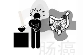 八成结直肠癌确诊已到中晚期，忠告：4个症状容易被忽视图片
