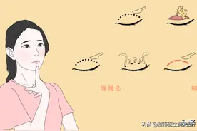 想做双眼皮？这些手术方式你会选吗？图片