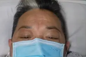 老戏骨张春年自曝出车祸骨折，手术完脚缠绷带，病床照曝光显憔悴图片