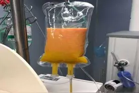 32周孕妇吃炸鸡腹痛入院，血液滤出几袋油！医生：不全怪炸鸡图片