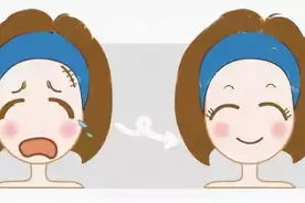 激光祛疤的原理你了解吗？图片