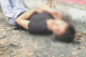 只好秃顶！男子深夜醉卧马路边，第二天醒来后发现头被粘住了图片