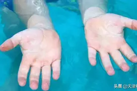 为什么泡水后手指会变皱图片