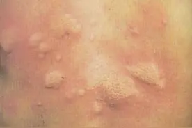 春季护肤大赏：防过敏抗干燥，一文让你了解图片