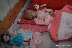 7岁患癌女童体重仅12公斤，女孩撒娇：妈妈，再抱抱我！图片