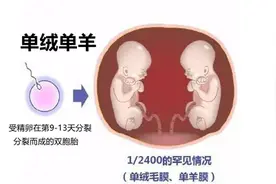 单绒单羊，单绒双羊，双绒双羊，双胞胎怎么分？来解答你所有疑问图片
