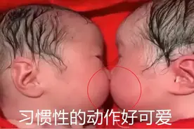 龙凤胎出生20分钟，哥哥妹妹“亲成一团”，护士直呼：太有爱了图片