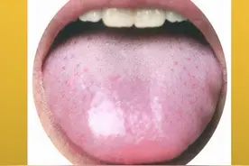 齿痕舌是怎么形成的？脾虚齿痕舌，产生的七个阶段，如何调理？图片
