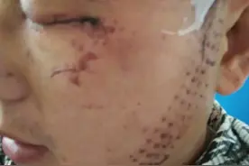 何苦！兄弟争宅基地，弟弟：亲哥举镐头打我，嫂子抠瞎我眼睛图片