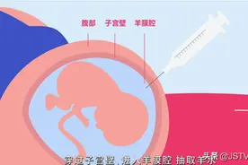 羊水穿刺做VS不做？图片